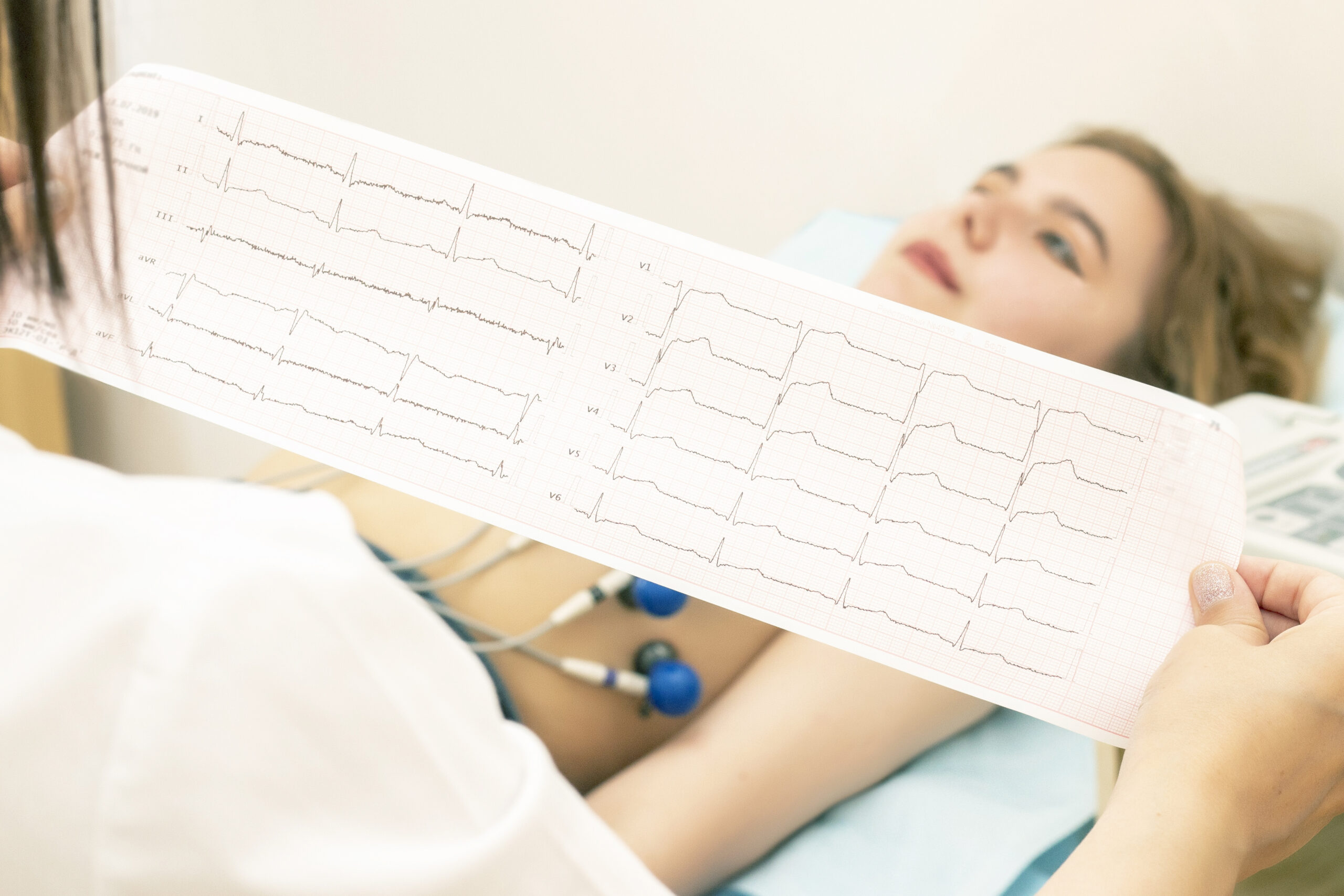 Guía de 3 pasos para reconocer un electrocardiograma normal (EKG/ECG)